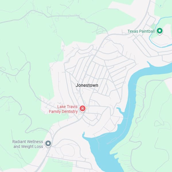 Kitchen Cabinet Restoration Company in Jonestown, TX